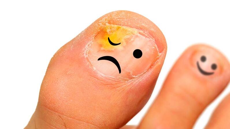 Nails