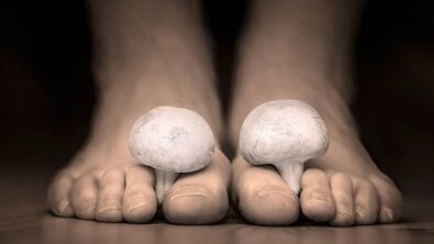 How to know the presence of fungi standing