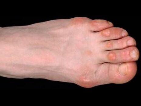 mushrooms on the feet